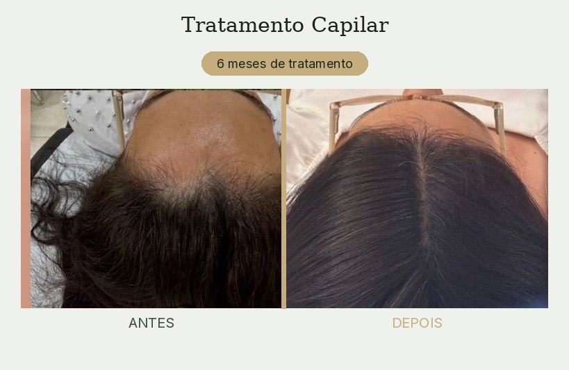 Resultado de tratamento de tricologia — Dra. Priscilla Della Lucia