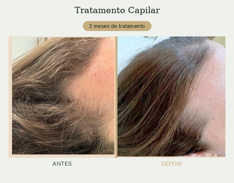 Resultado de tratamento de tricologia — Dra. Priscilla Della Lucia
