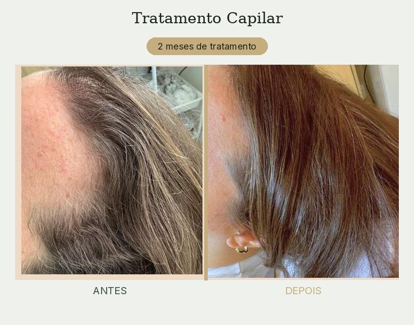Resultado de tratamento de tricologia — Dra. Priscilla Della Lucia