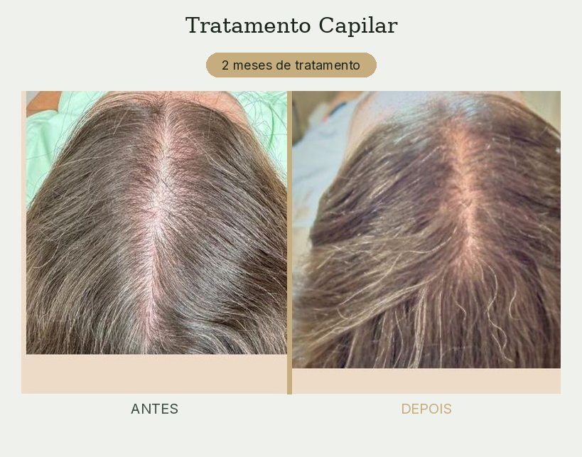 Resultado de tratamento de tricologia — Dra. Priscilla Della Lucia